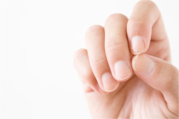 Doenças de Unhas e Unhas Fracas